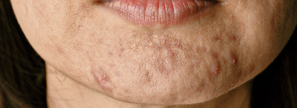 04---Blog---Cravos---01