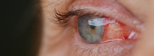 07---Blog---pomada-02